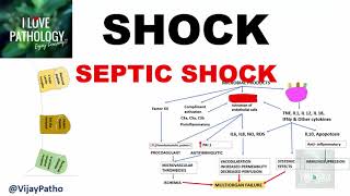 Sepsis amp Septic Shock  SketchyIM USMLE Step 2 Review [upl. by Rheingold632]