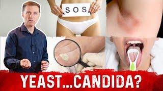 Yeast Infection vs Candida Infection Is there a Difference – DrBerg [upl. by Elisabetta]