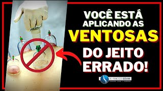 VENTOSATERAPIA  03 ERROS que MUITOS FISIOTERAPEUTAS COMETEM ao Aplicar as Ventosas de Acrílico [upl. by Acirred]