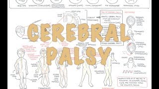 Cerebral Palsy  DETAILED Overview [upl. by Giordano]