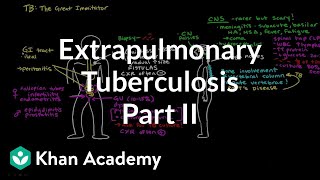 Extrapulmonary TB Part 2  Infectious diseases  NCLEXRN  Khan Academy [upl. by Ettenajna]