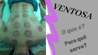 ⚫Ventosaterapia  o que é e para quê serve [upl. by Edva]