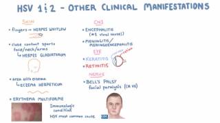 HSV  Clinical Presentation  Part 2 [upl. by Mit]