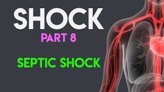 Septic Shock  Shock Part 8 [upl. by Henning]