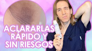 COMO ACLARAR LAS AXILAS  Recomendaciones de un dermatólogo [upl. by Idorb]