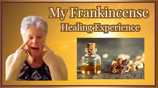 Frankincense Helped Me A Cancer Survivors Journey [upl. by Stutzman]