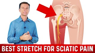 Best Stretches for Sciatica Nerve Pain Relief – Dr Berg [upl. by Znerol]