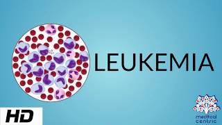 Leukemia  Causes and Symptoms  Part 33 [upl. by Midge]