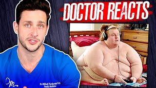 The Harsh Reality Of Being 800 Pounds  Doctor Reacts [upl. by Anoed]