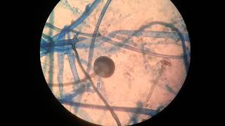 Rhizopus [upl. by Ennalyrehc]