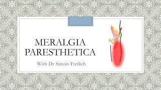 Meralgia Paresthetica [upl. by Aiuqal]