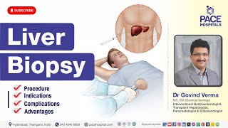 Liver Biopsy  Procedure Indications Complications amp Advantages  Liver Biopsy Procedure [upl. by Prunella]