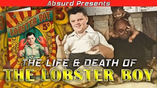 The Life And Death Of The Lobster Boy [upl. by Ihculo977]