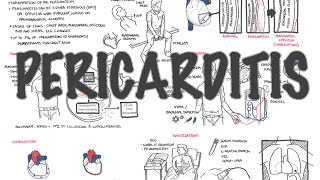 Echocardiography Essentials Detecting pericardial effusions [upl. by Plerre]