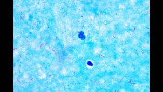 Mycobacterium under microscope afb positive [upl. by Seely154]