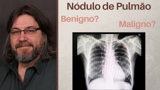 Nodulo Pulmonar o que é e o que fazer [upl. by Cappello]