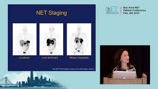 Imaging brain tumors  4  Other low grade gliomas [upl. by Tracee]