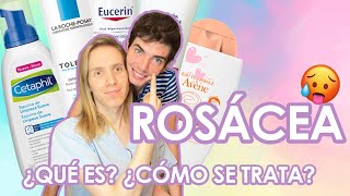 ¿Qué es la ROSACEA ¿Cómo se trata  Productos que recomiendo [upl. by Sapphire]