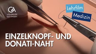 Einzelknopf und DonatiNaht [upl. by Assirim]